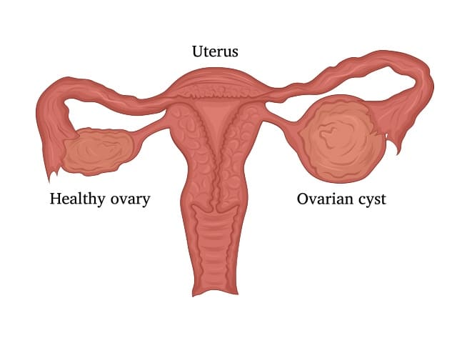 healthy human ovaries